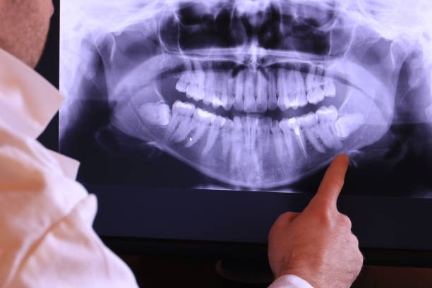 Best Emergency Dentist for Lost Fillings or Crowns in Tysons, VA