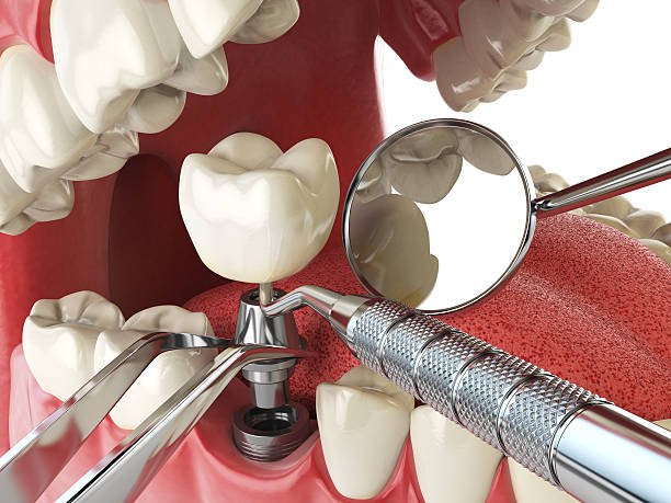 Best Weekend Emergency Dentist in Tysons, VA