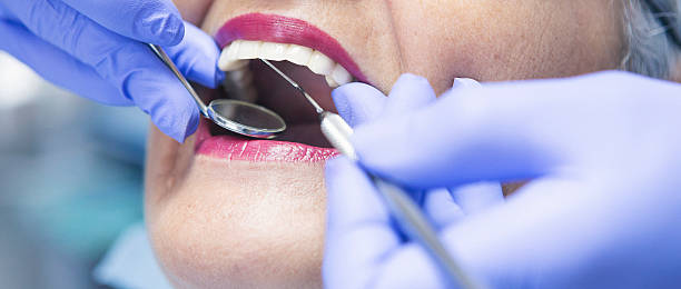 Best Emergency Dentist for Special Needs Patients in Tysons, VA
